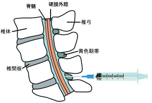 ペインクリニック外科 | 東新宿整形外科リハビリクリニック | 東新宿駅1分