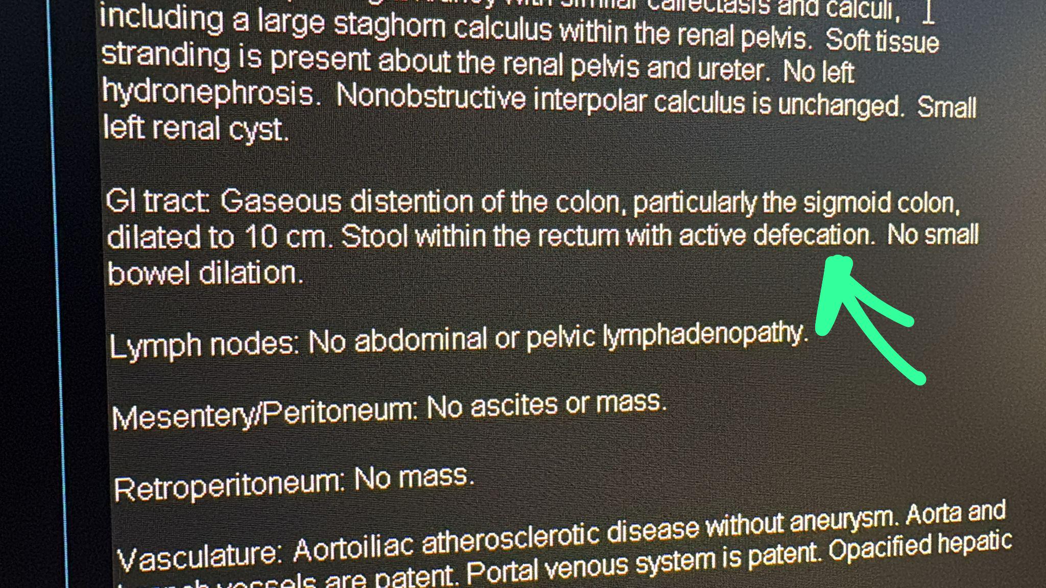Finally clinical correlation is not recommended : r/Radiology