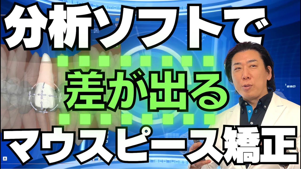尾島先生が使っているデジタルアライナー矯正の分析ソフトをご紹介し