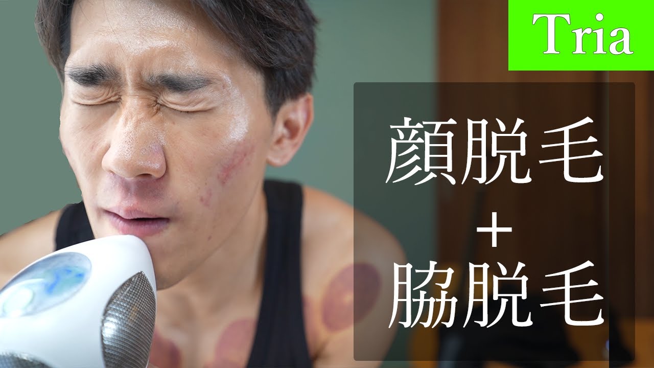 トリアレベル5で顔脱毛！ムダ毛脱毛ならトリアが一番。（ヒゲ脱毛＋脇