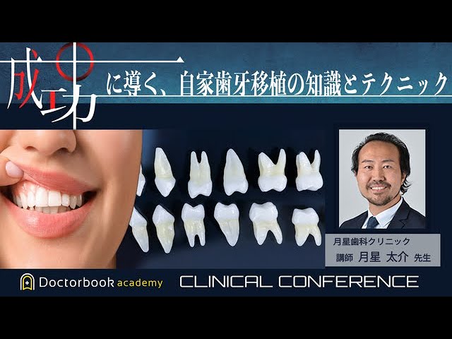 成功に導く自家歯牙移植の知識とテクニック 月星 太介先生 - YouTube