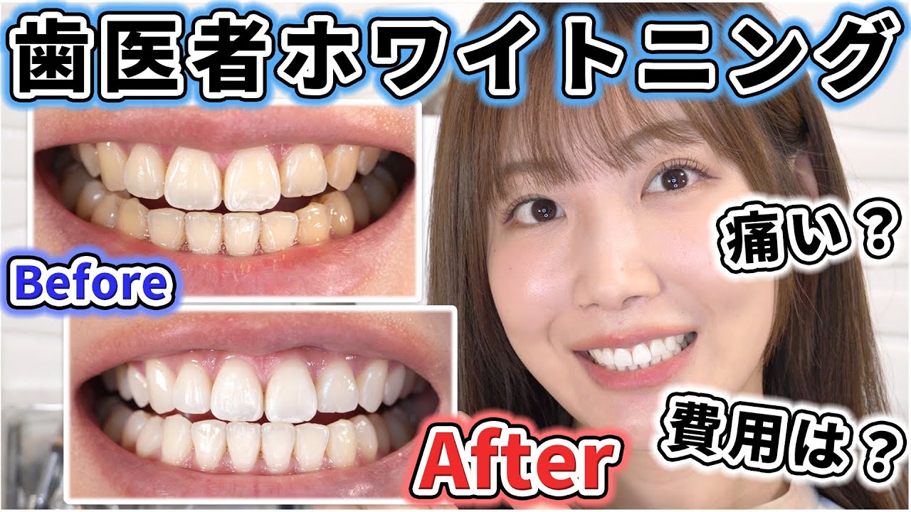 Dr Visea新発売！最新型ホワイトニングマシンのご紹介 - YouTube