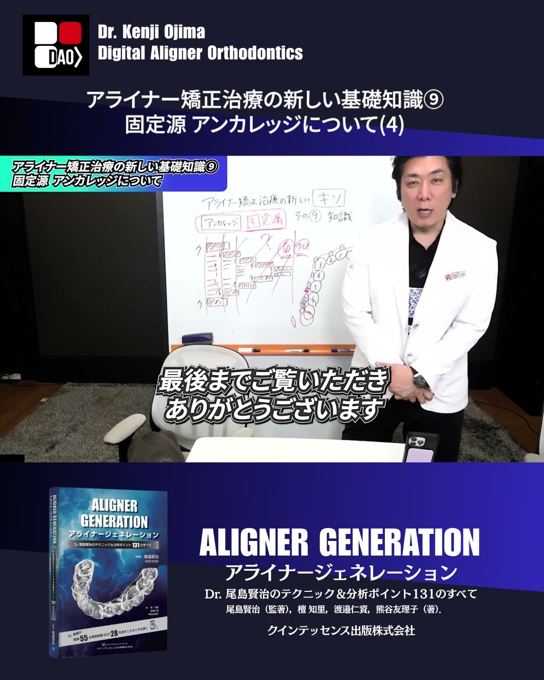 アライナー矯正治療の『基礎知識』（9）固定源 アンカレッジについて4