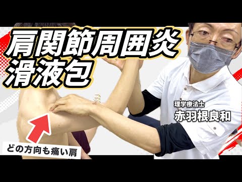 Paid Level] The Origins of Shoulder Joint Treatment. Bursa