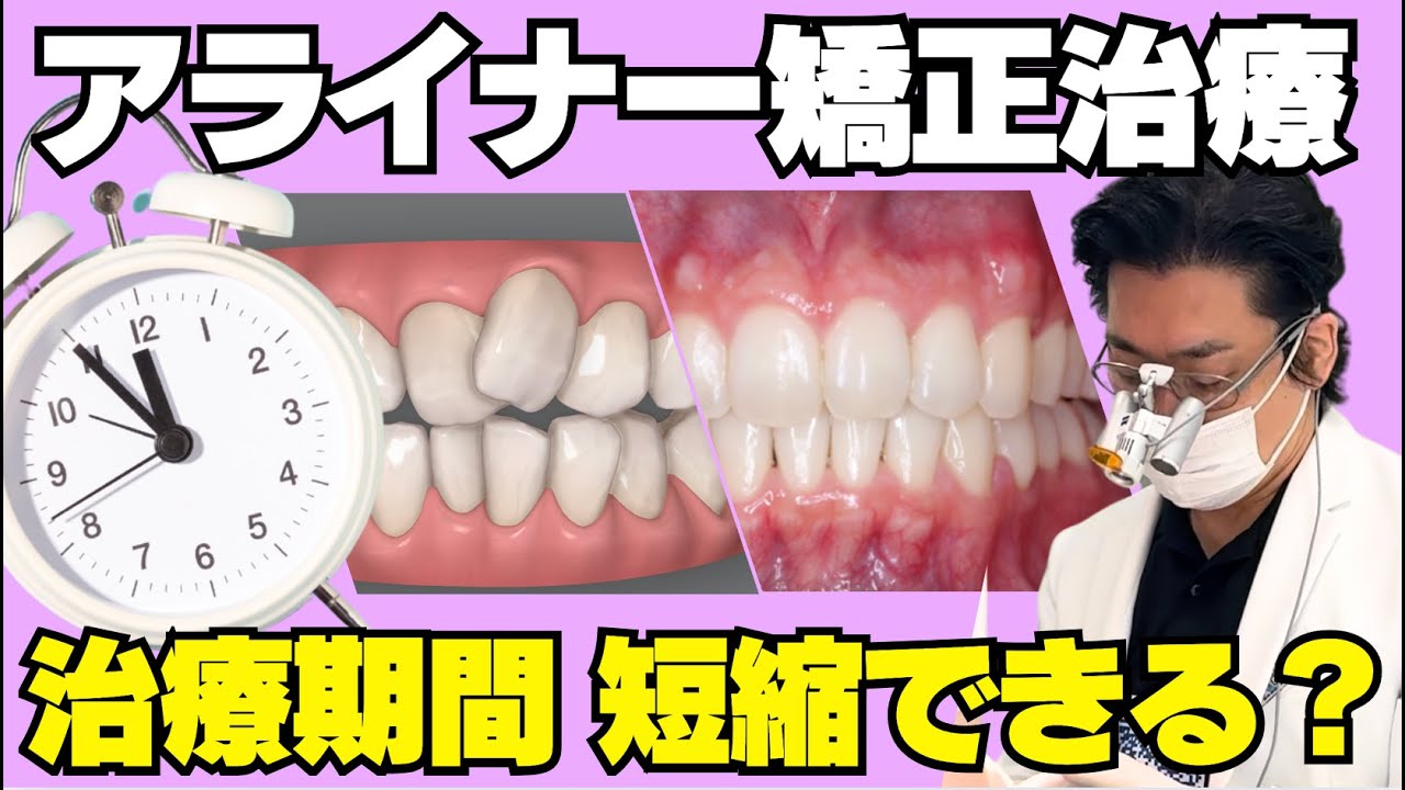 アライナー矯正治療の期間を短くするための工夫を解説します - YouTube