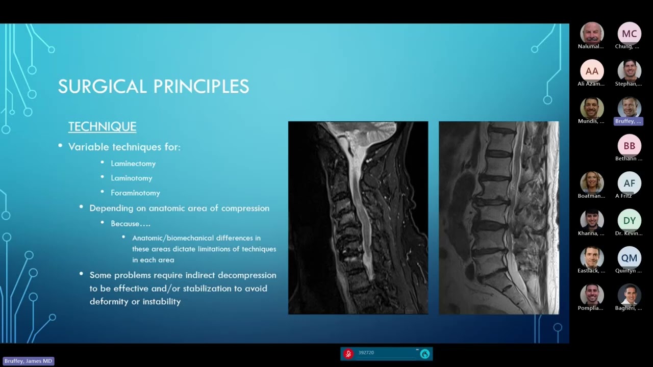 Spine Surgery Posterior Decompression Techniques presented by