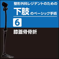 整形外科レジデントのための下肢のベーシック手術3 人工股関節全置換術