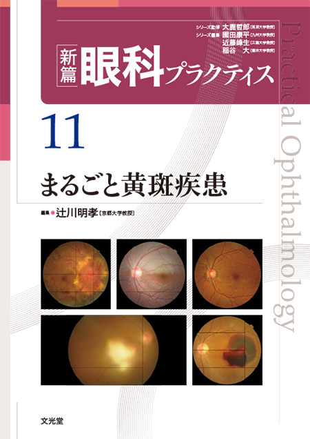 m3電子書籍 | 眼科レジデントのためのベーシック手術 第2版