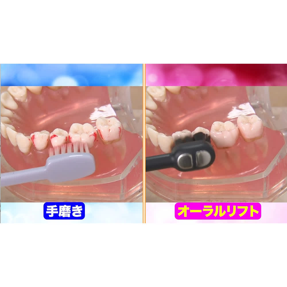 YA-MAN/ヤーマン オーラルリフト クリア 通販 - ディノス