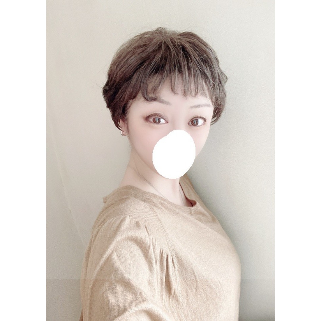 アデランス - フォンテーヌ VALAN PREMIUM VP05 人工スキン付き