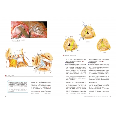 大動脈疾患の手術 心臓血管外科手術エクセレンス : 大北裕 | HMV&BOOKS