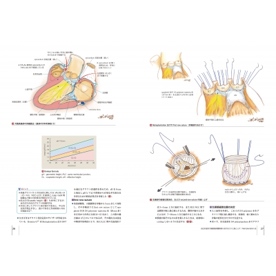大動脈疾患の手術 心臓血管外科手術エクセレンス : 大北裕 | HMV&BOOKS