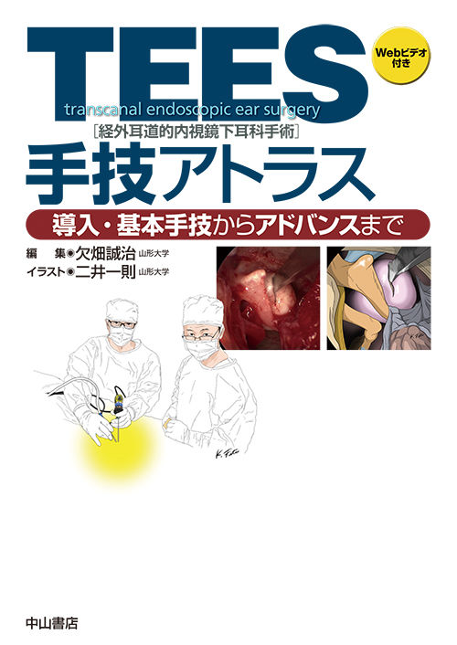 TEES（経外耳道的内視鏡下耳科手術）手技アトラス 欠畑誠治(編) - 中山