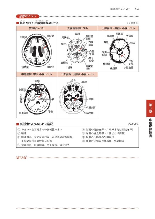 理学療法士・作業療法士国家試験必修ポイント 障害別PT治療学 2025