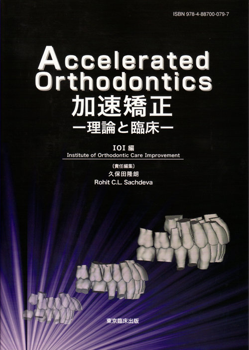 治療期間短縮のための当院の取り組み - 【公式】日本橋はやし矯正歯科