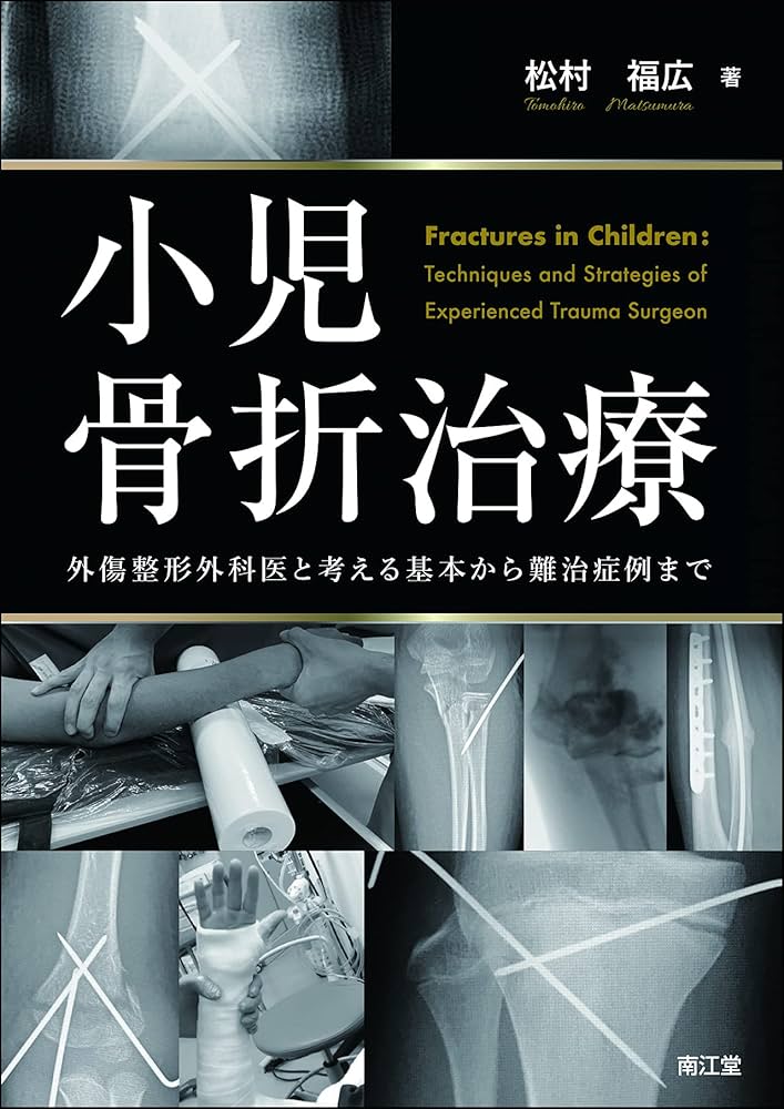 小児骨折治療: 外傷整形外科医と考える基本から難治症例まで | 松村福