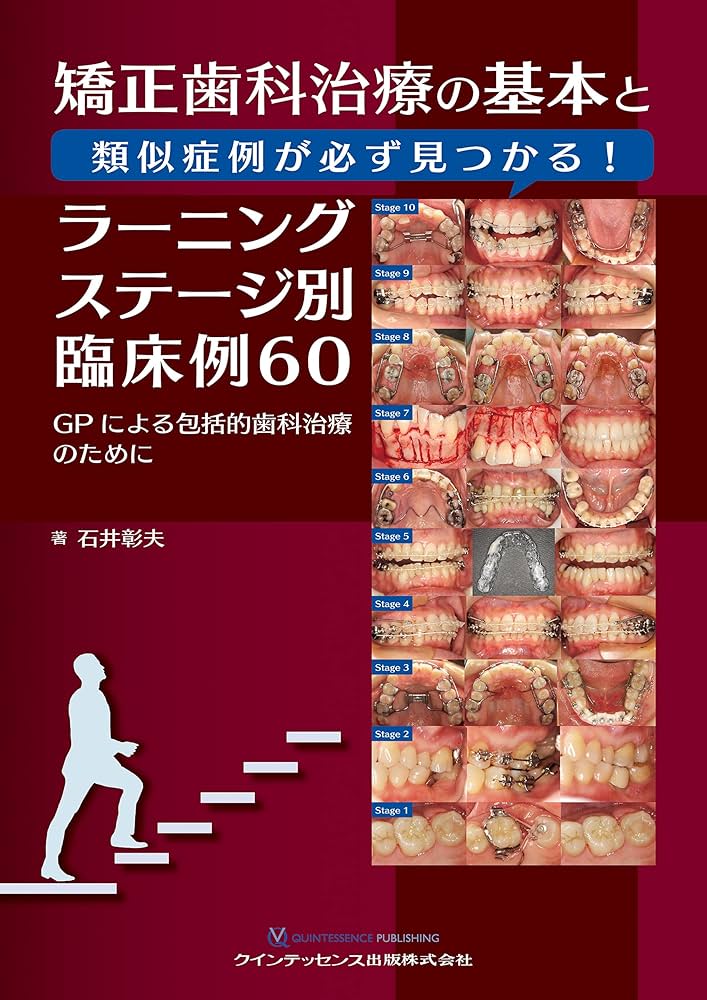 矯正歯科治療の基本と類似症例が必ず見つかる! ラーニングステージ別