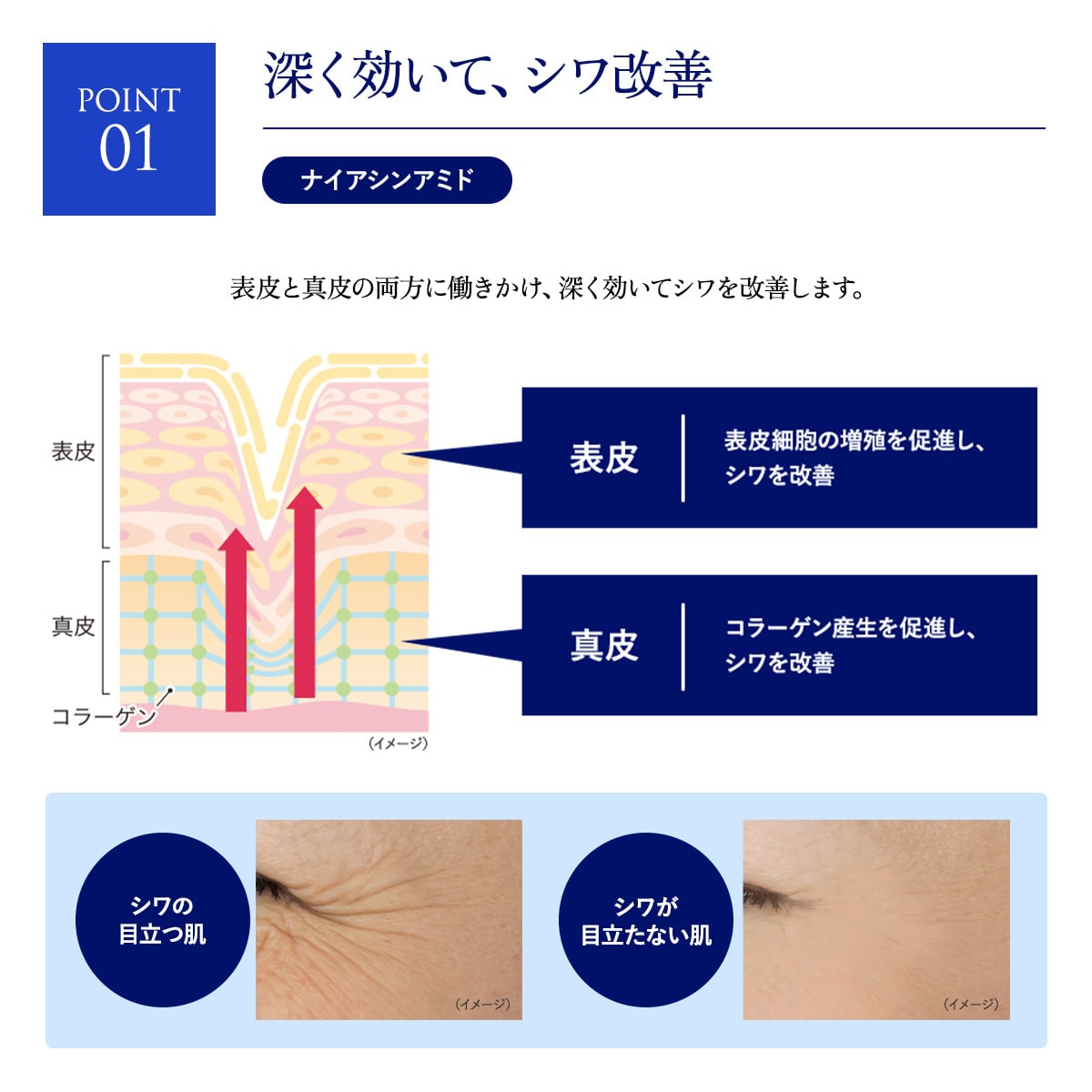 公式】エクスバリア 薬用 ディープ リペア ゲル リンクル＆ホワイト