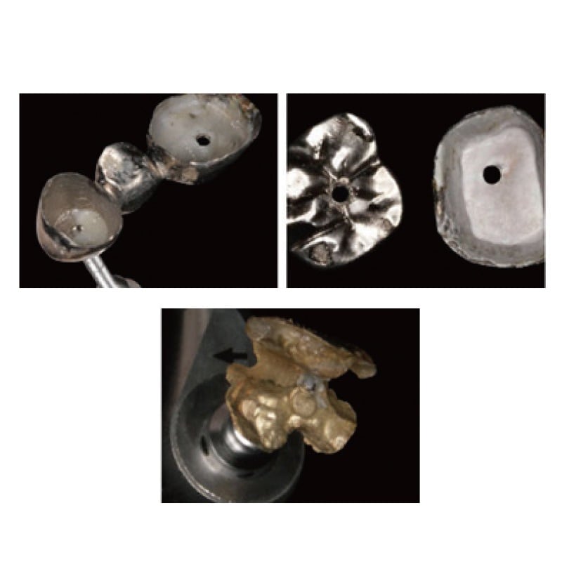 ECR(イージークラウンリムーバー) セット[Forest-one] | インスツル