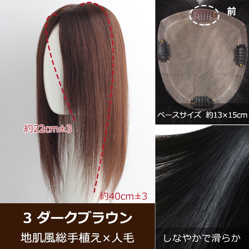 9_000000010724.jpg?1769408646