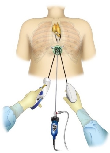 呼吸器外科 | 藤田医科大学 岡崎医療センター
