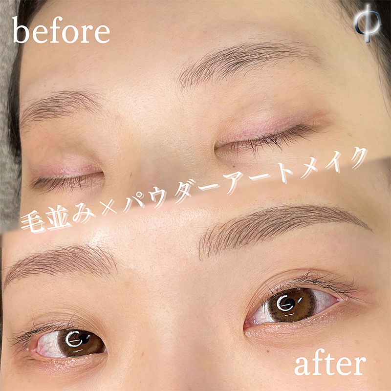 眉アートメイク - 【京都の美容外科】フィロクリニック | 河原町御池