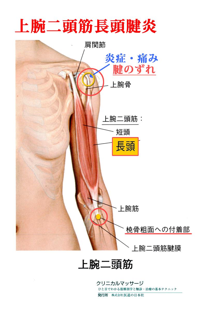 天城流湯治法 肩痛 腕痛 天城流マイスター 小松 隆