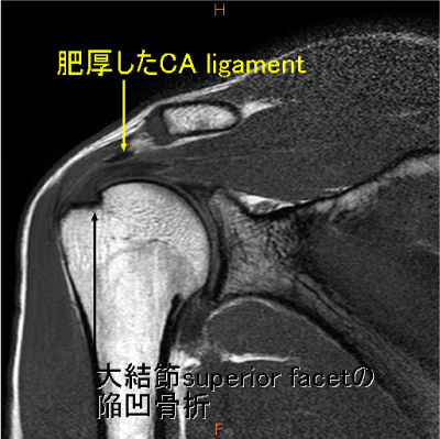 症例12 / Ryuji's room [佐志隆士]