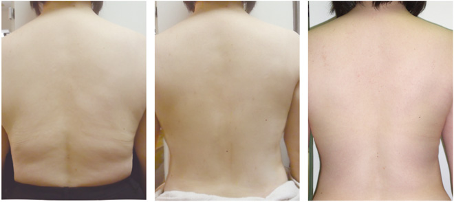 2Bバイオトリートメント｜東京・福岡・鹿児島でブラジリアンワックスや