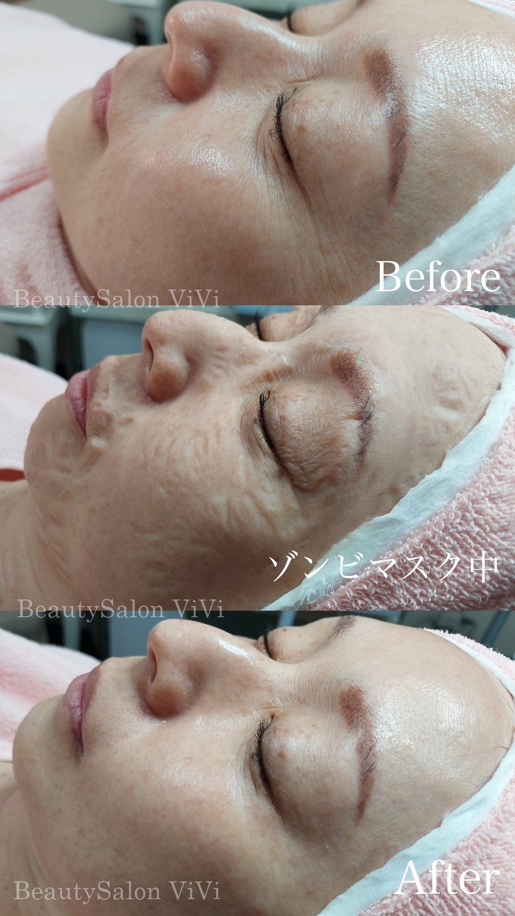 ゾンビマスクがスゴい！！ - フェイシャルエステ・毛穴洗浄・眉毛の