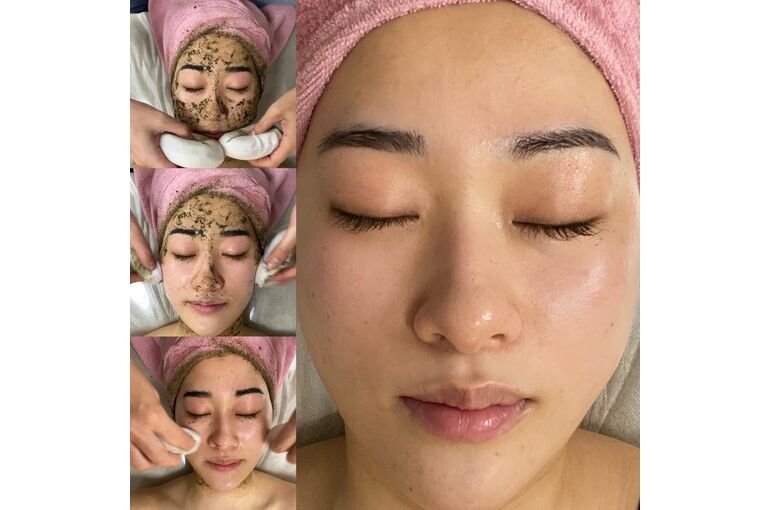 剥離しないハーブピーリング『REVI陶肌トリートメント』は敏感肌でも