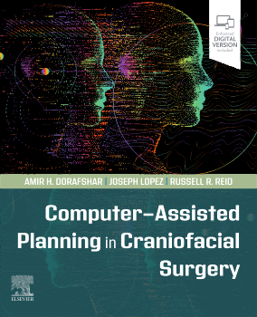 Local Flaps in Facial Reconstruction - 4th Edition | Elsevier Shop