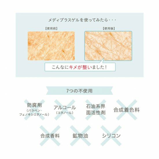 メディプラスゲルDX Mediplus Gel DX | 公式 | セイコメディカル