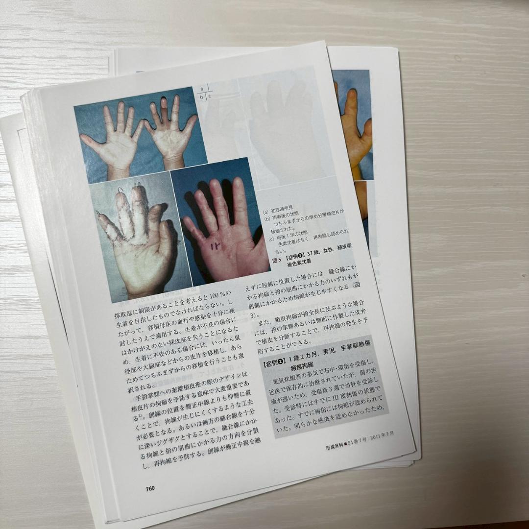 裁断済】形成外科 54巻 7号 手の外科の基本手技 - メルカリ