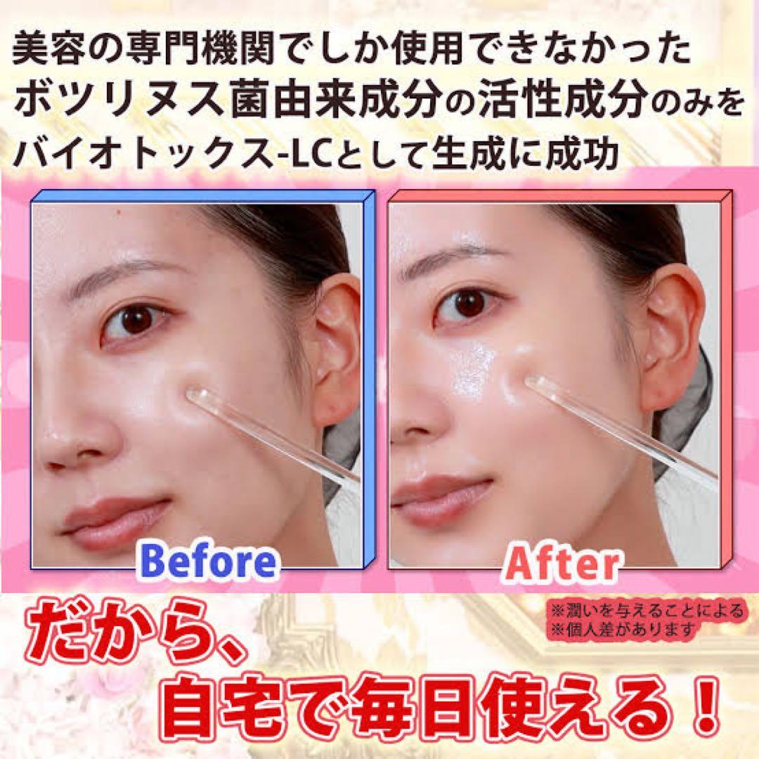 QWEENTOX MeMeLift 美顔器 - メルカリ