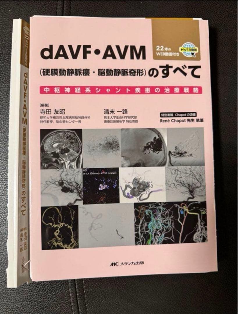 dAVF・AVM(硬膜動静脈瘻・脳動静脈奇形)のすべて 【裁断済】 - メルカリ