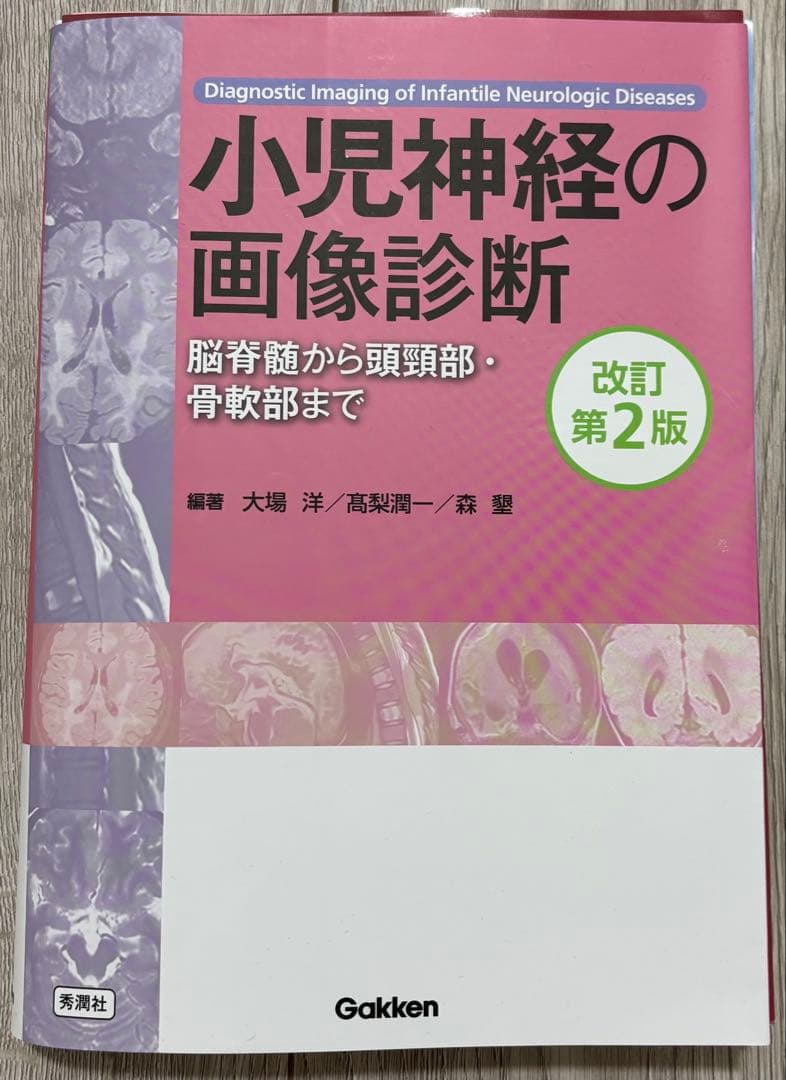小児神経の画像診断 改訂第2版 すぐわかる小児の画像診断 改訂第2版 (画像診断別冊KEYBOOKシリーズ